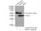 Pyruvate dehydrogenase E1 component subunit alpha, somatic form, mitochondrial antibody, 66119-1-Ig, Proteintech Group, Immunoprecipitation image 