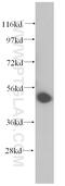 Uridine Monophosphate Synthetase antibody, 14830-1-AP, Proteintech Group, Western Blot image 