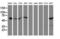 Sequestosome 1 antibody, LS-C172378, Lifespan Biosciences, Western Blot image 