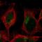 Transmembrane Protein 104 antibody, PA5-60676, Invitrogen Antibodies, Immunofluorescence image 