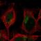 Transmembrane Protein 104 antibody, PA5-60676, Invitrogen Antibodies, Immunofluorescence image 