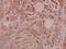 Integrin Subunit Beta 3 antibody, A00587S778, Boster Biological Technology, Immunohistochemistry frozen image 