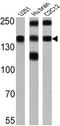 ATPase Plasma Membrane Ca2+ Transporting 1 antibody, NB300-578, Novus Biologicals, Western Blot image 