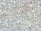 Protein Phosphatase Methylesterase 1 antibody, GTX115970, GeneTex, Immunohistochemistry paraffin image 