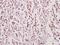 Cytochrome C Oxidase Copper Chaperone COX11 antibody, A09173-1, Boster Biological Technology, Immunohistochemistry paraffin image 