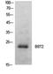 Bone Marrow Stromal Cell Antigen 2 antibody, LS-C743153, Lifespan Biosciences, Western Blot image 