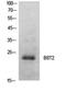 Bone Marrow Stromal Cell Antigen 2 antibody, LS-C743153, Lifespan Biosciences, Western Blot image 