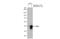 Fos-related antigen 1 antibody, GTX134242, GeneTex, Western Blot image 