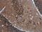 Protein Tyrosine Kinase 2 Beta antibody, GTX633918, GeneTex, Immunohistochemistry paraffin image 