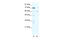 Forkhead Box J2 antibody, 27-743, ProSci, Western Blot image 