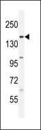 BCL6 Corepressor Like 1 antibody, 55-463, ProSci, Western Blot image 