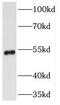 Transmembrane Serine Protease 5 antibody, FNab08807, FineTest, Western Blot image 