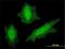 Von Hippel-Lindau Tumor Suppressor antibody, H00007428-M01, Novus Biologicals, Immunofluorescence image 