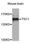 TSC Complex Subunit 1 antibody, LS-C331096, Lifespan Biosciences, Western Blot image 