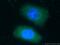 G protein-activated inward rectifier potassium channel 1 antibody, 16985-1-AP, Proteintech Group, Immunofluorescence image 