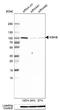 Inhibitor Of Nuclear Factor Kappa B Kinase Subunit Beta antibody, NBP1-87699, Novus Biologicals, Western Blot image 