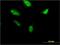 Ring Finger Protein 212 antibody, H00285498-M01, Novus Biologicals, Immunocytochemistry image 