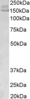A-Kinase Anchoring Protein 12 antibody, STJ70021, St John