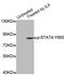 Signal Transducer And Activator Of Transcription 4 antibody, STJ22416, St John