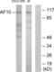 MLLT10 Histone Lysine Methyltransferase DOT1L Cofactor antibody, LS-C118945, Lifespan Biosciences, Western Blot image 