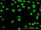 Transcriptional repressor protein YY1 antibody, LS-B5549, Lifespan Biosciences, Immunofluorescence image 