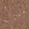 ACK1 antibody, NBP1-90822, Novus Biologicals, Immunohistochemistry paraffin image 