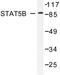 Signal Transducer And Activator Of Transcription 5B antibody, LS-C176574, Lifespan Biosciences, Western Blot image 