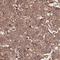 RNA Pseudouridine Synthase D3 antibody, HPA037551, Atlas Antibodies, Immunohistochemistry frozen image 