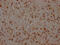 Mitogen-Activated Protein Kinase Kinase 1 antibody, CSB-RA957619A0HU, Cusabio, Immunohistochemistry frozen image 