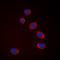 Mitogen-Activated Protein Kinase Kinase Kinase 8 antibody, abx133059, Abbexa, Western Blot image 