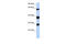 Sm-B/B antibody, ARP40443_P050, Aviva Systems Biology, Western Blot image 