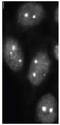 Small Ubiquitin Like Modifier 2 antibody, GTX00699, GeneTex, Immunofluorescence image 