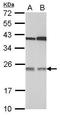 Transmembrane emp24 domain-containing protein 7 antibody, GTX106658, GeneTex, Western Blot image 