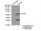 Keratin 6B antibody, 17391-1-AP, Proteintech Group, Immunoprecipitation image 