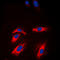 Creatine Kinase, M-Type antibody, LS-C352028, Lifespan Biosciences, Immunofluorescence image 