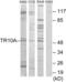 TNF Receptor Superfamily Member 10a antibody, abx013263, Abbexa, Western Blot image 