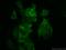 Angio-associated migratory cell protein antibody, 21220-1-AP, Proteintech Group, Immunofluorescence image 