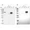 Acyl-CoA Synthetase Short Chain Family Member 3 antibody, PA5-58750, Invitrogen Antibodies, Western Blot image 