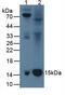 Beta-2-Microglobulin antibody, abx131742, Abbexa, Western Blot image 