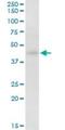 Homer Scaffold Protein 2 antibody, H00009455-D01P, Novus Biologicals, Western Blot image 