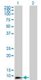 Defensin Beta 4B antibody, LS-C197042, Lifespan Biosciences, Western Blot image 