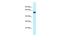 Endonuclease/Exonuclease/Phosphatase Family Domain Containing 1 antibody, PA5-69536, Invitrogen Antibodies, Western Blot image 