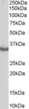 STIP1 Homology And U-Box Containing Protein 1 antibody, NB300-982, Novus Biologicals, Western Blot image 