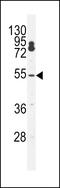 Cleavage And Polyadenylation Specific Factor 7 antibody, 56-247, ProSci, Western Blot image 