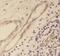 Tripeptidyl Peptidase 1 antibody, FNab08894, FineTest, Immunohistochemistry paraffin image 