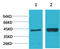 NFKB Inhibitor Alpha antibody, STJ97440, St John