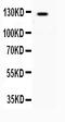 AF4/FMR2 Family Member 4 antibody, A03824, Boster Biological Technology, Western Blot image 