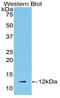 C-C motif chemokine 5 antibody, LS-C298870, Lifespan Biosciences, Western Blot image 