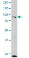 Lysine Acetyltransferase 2A antibody, H00002648-M01, Novus Biologicals, Western Blot image 