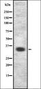 CREB Regulated Transcription Coactivator 3 antibody, orb336903, Biorbyt, Western Blot image 